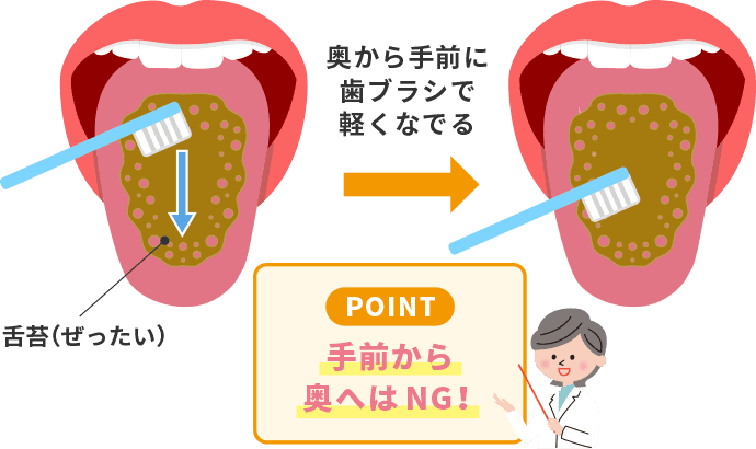 舌苔の磨き方